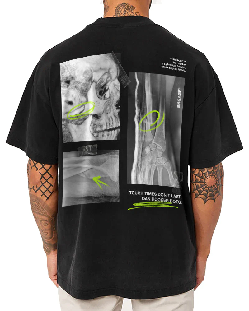 Dan Hooker 'Just a Scratch' Oversized Supporter T-Shirt - Image 3